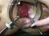 Anal gaping with an anal spreader