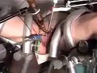 urethra Sounding With E-Stim