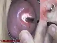 Girl Cervix Playing with Endoscope Japanese Camera into Uterus